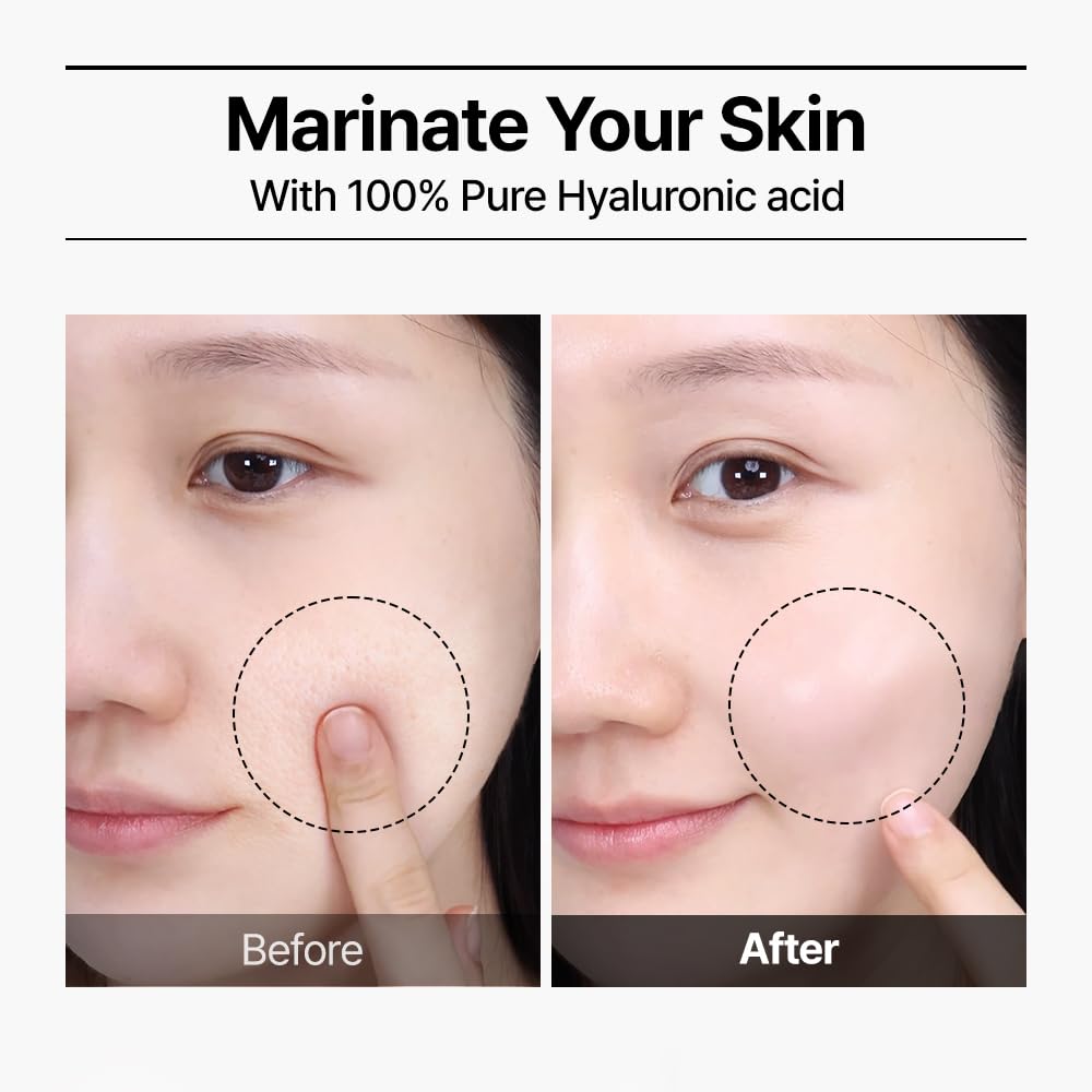 WELLAGE Real Hyaluronic Blue Ampoule 100, Korean Hydrating Serum for Face, Fragrance Free Hyaluronic Acid Deep Moisturizing Serum with Panthenol, PDRN for Sensitive Dry Skin Moisturizer, 2.54 Fl Oz_R