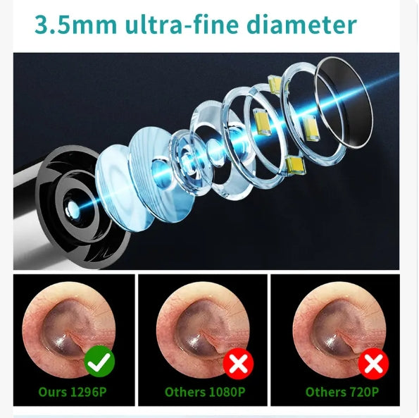 [FONENYCA] 2026 new Novel Ear Wax Removal, Ear CleanerwithCamera and Light
