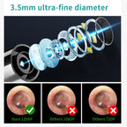 [FONENYCA] 2026 new Novel Ear Wax Removal, Ear CleanerwithCamera and Light